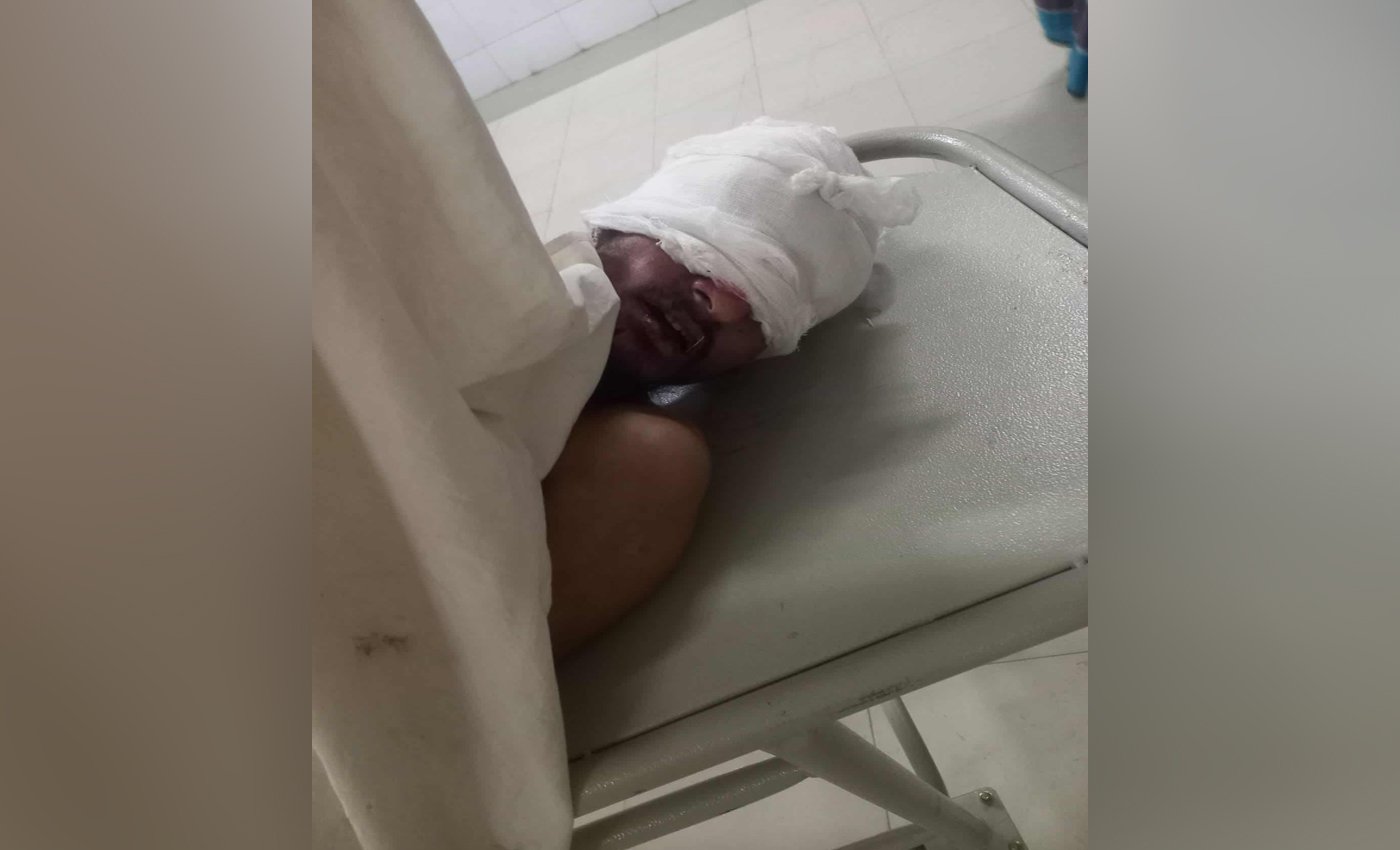 পাকুন্দিয়ায় সিএনজি-পিকআপ সংঘর্ষে শিশুসহ ৯ জন আহত